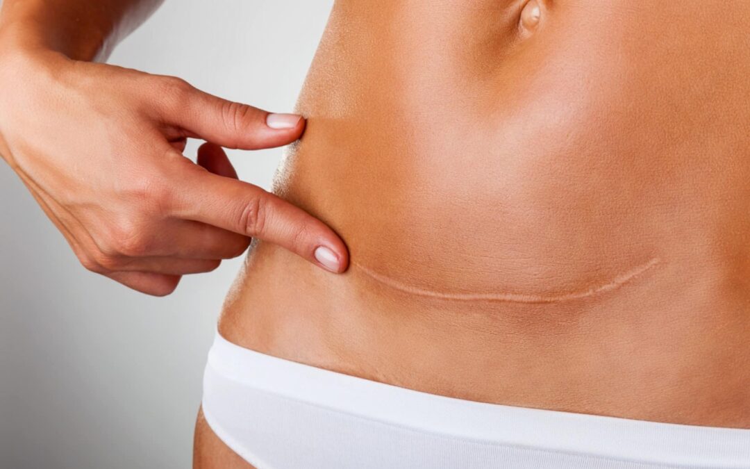 UrgoTouch : l’innovation laser qui révolutionne la cicatrisation en chirurgie esthétique